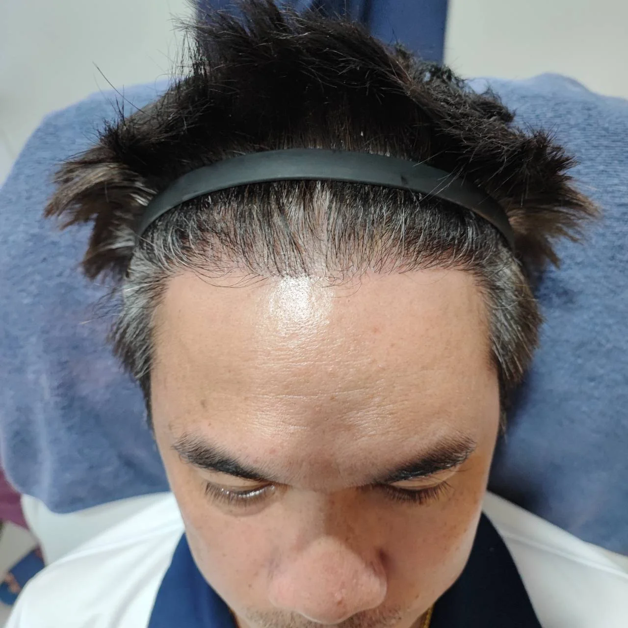 Case review of a Thai customer aged 50 years