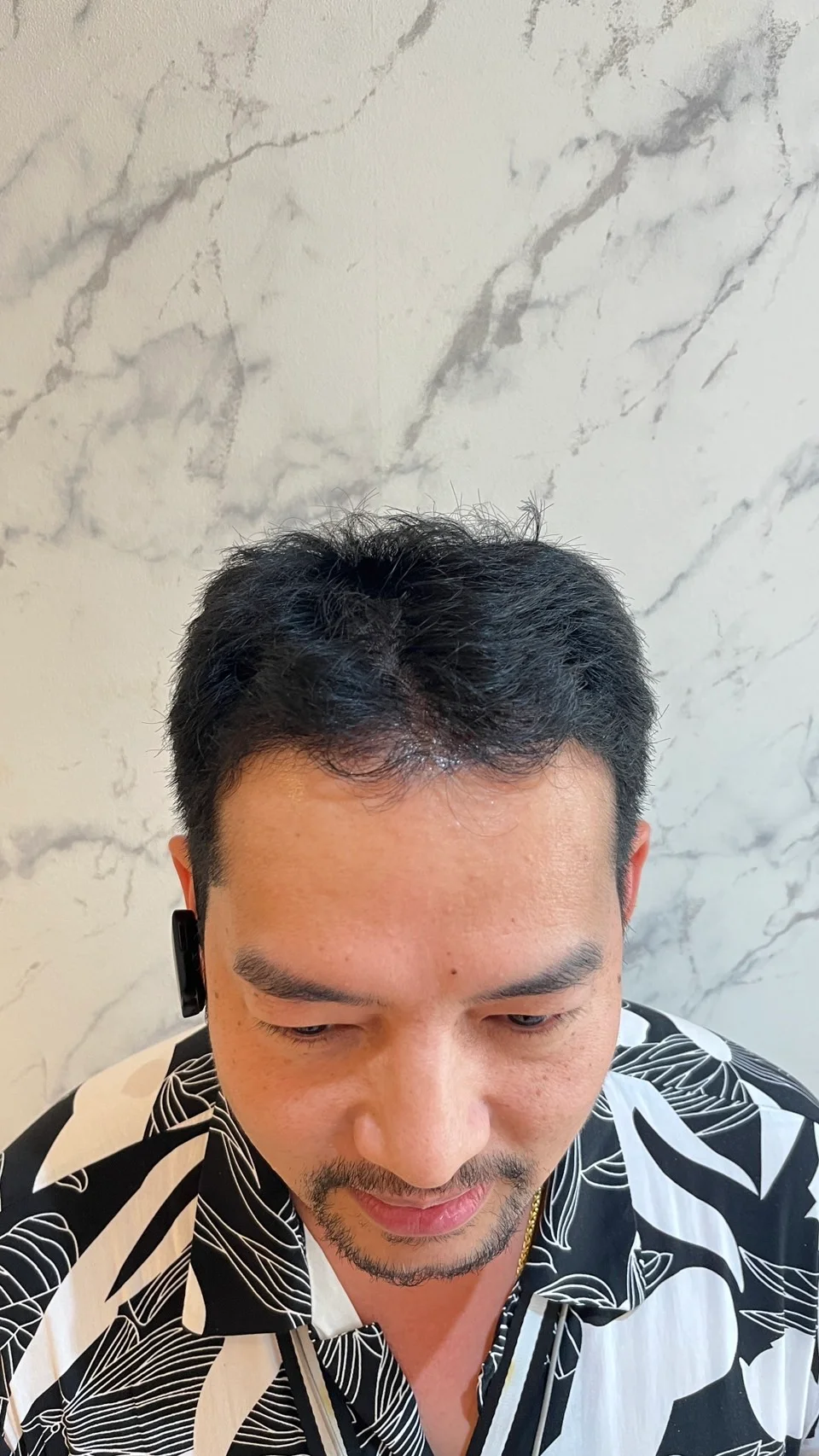 Case Review Thai Customer, 42 years old