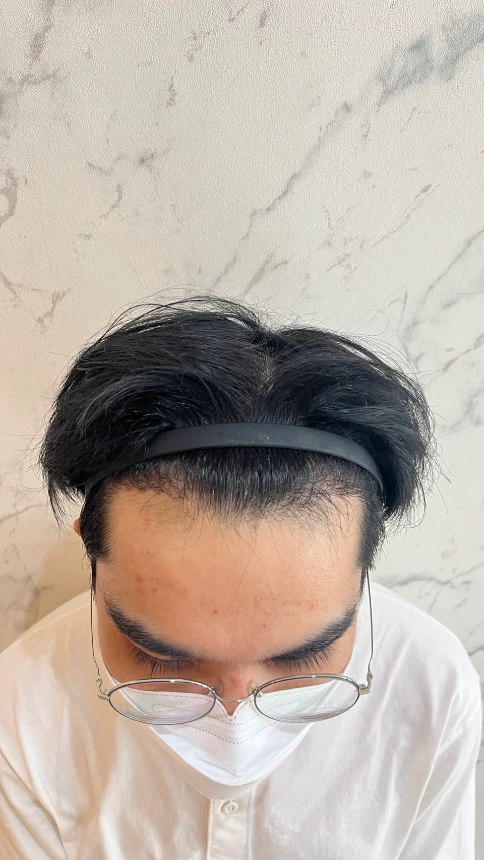 Case Review Thai Customer, 22 years old