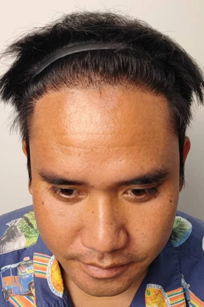 Review Cases : Thai Customer, 28 years old