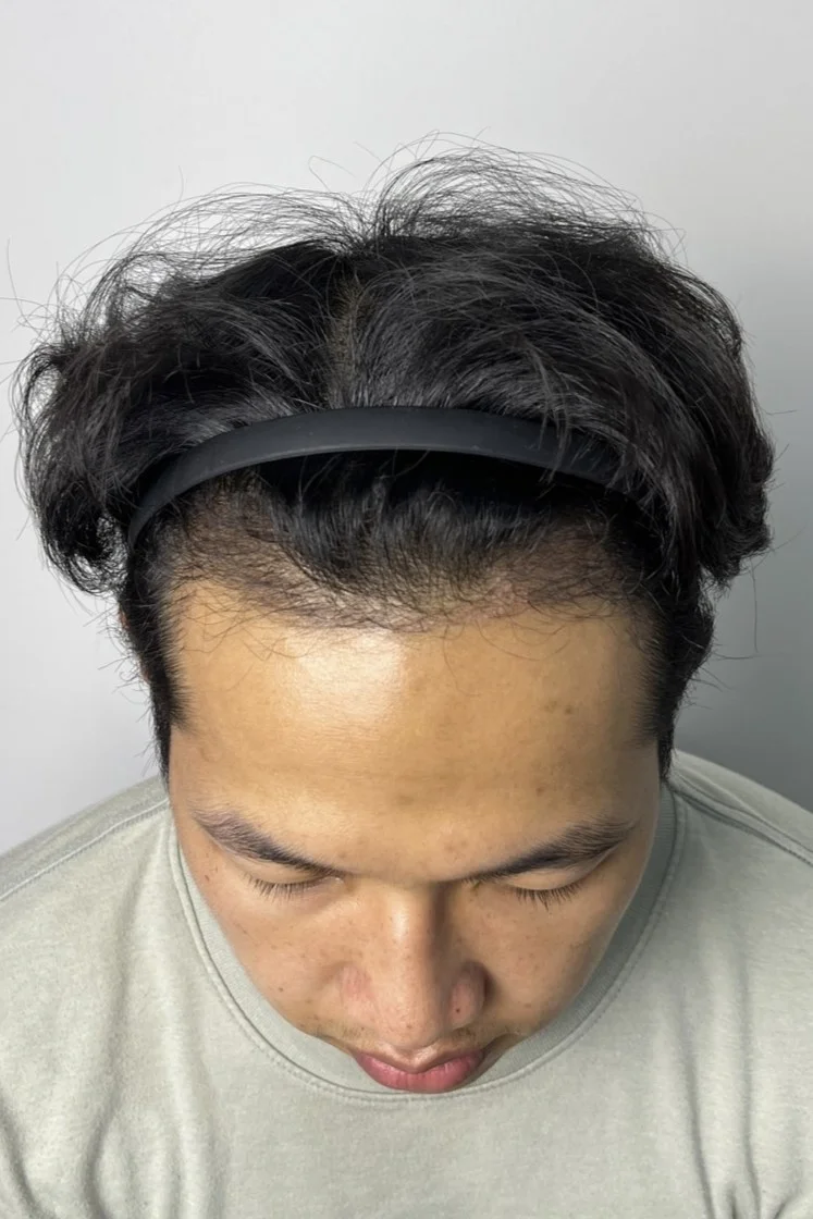 Review Cases: Thai Customer, 22 years old