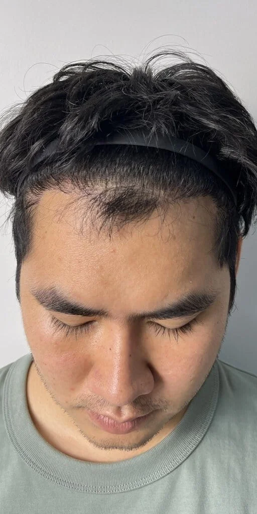 Review Cases : Thai Customer, 28 years old