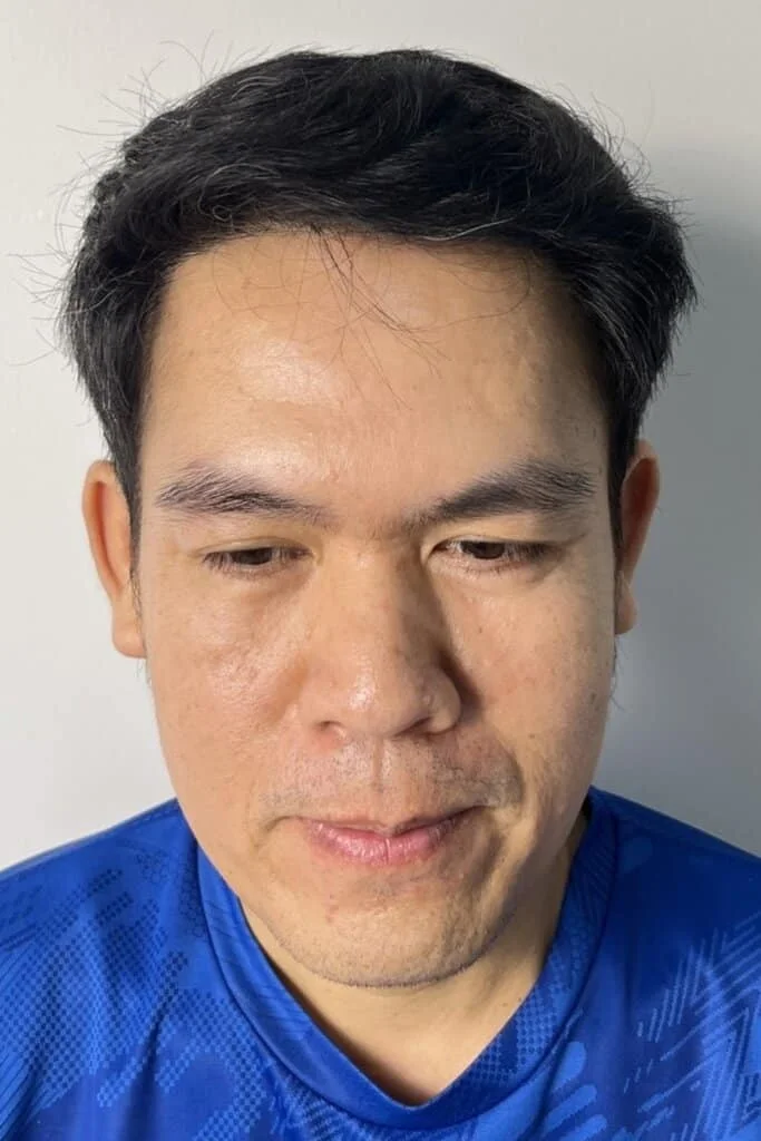 Review Cases : Thai Customer, 42 years old