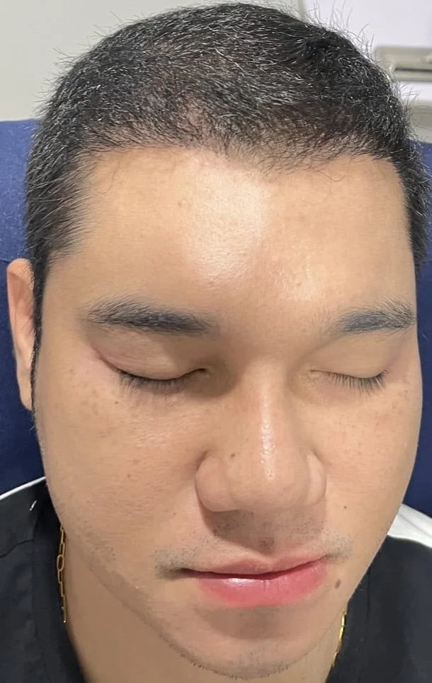 Review Cases : Thai Customer, 32 years old
