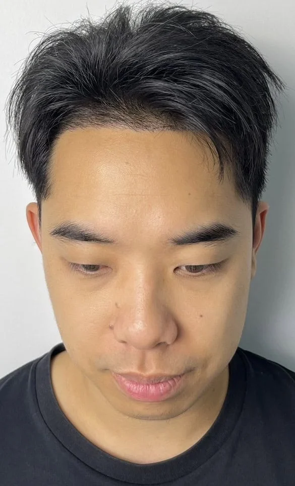 Review Cases : Thai Customer, 28 years old