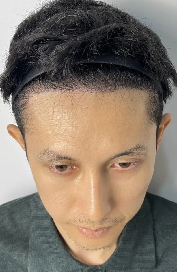 Review Cases : Thai Customer, 34 years old
