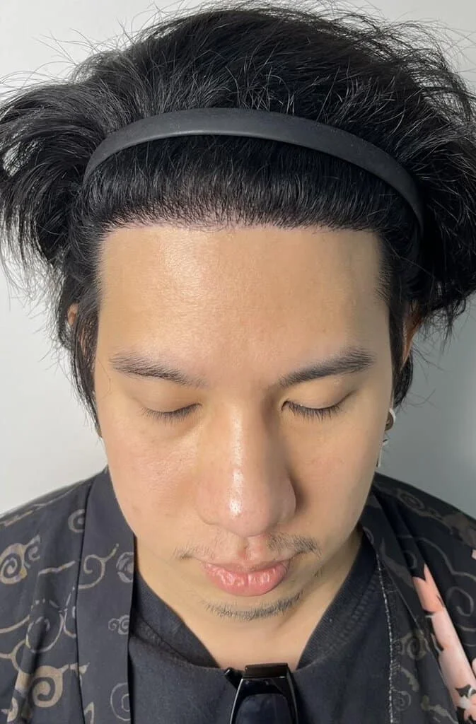 Review Cases : Thai Customer, 27 Years Old