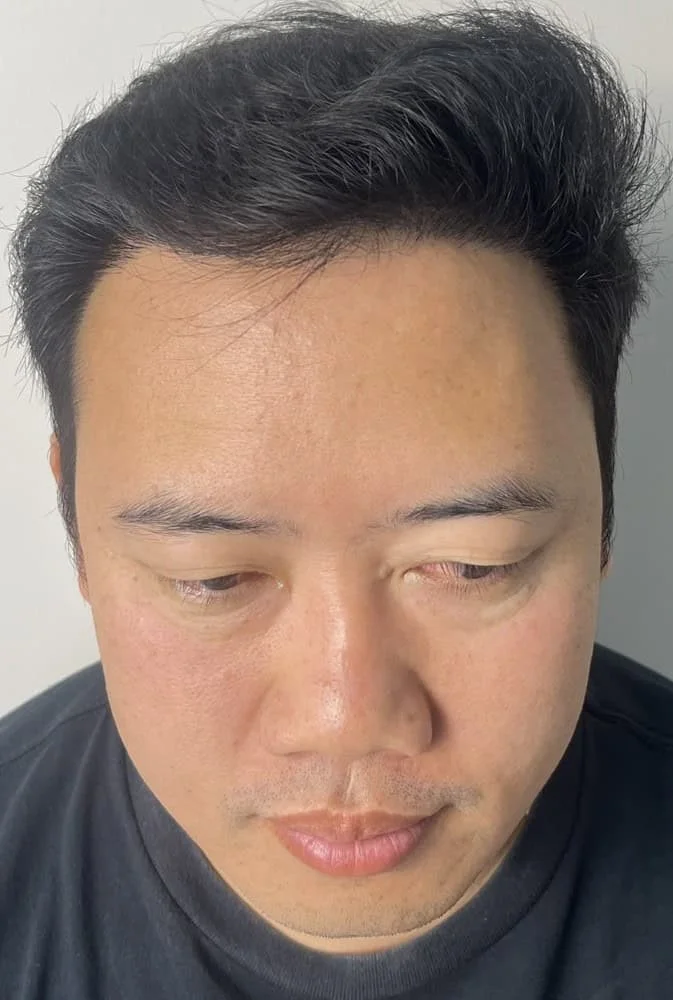 Review Cases : Thai Customer, 37 Years Old