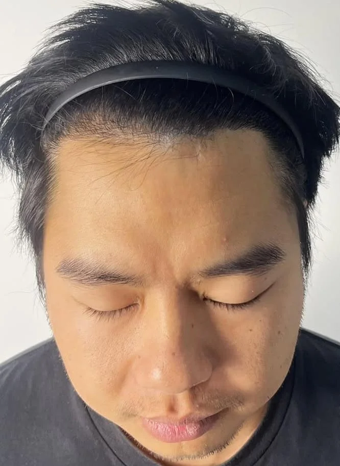Review Cases : Thai Customer, 32 years old