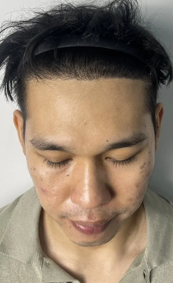 Review Cases : Thai Customer, 35 years old