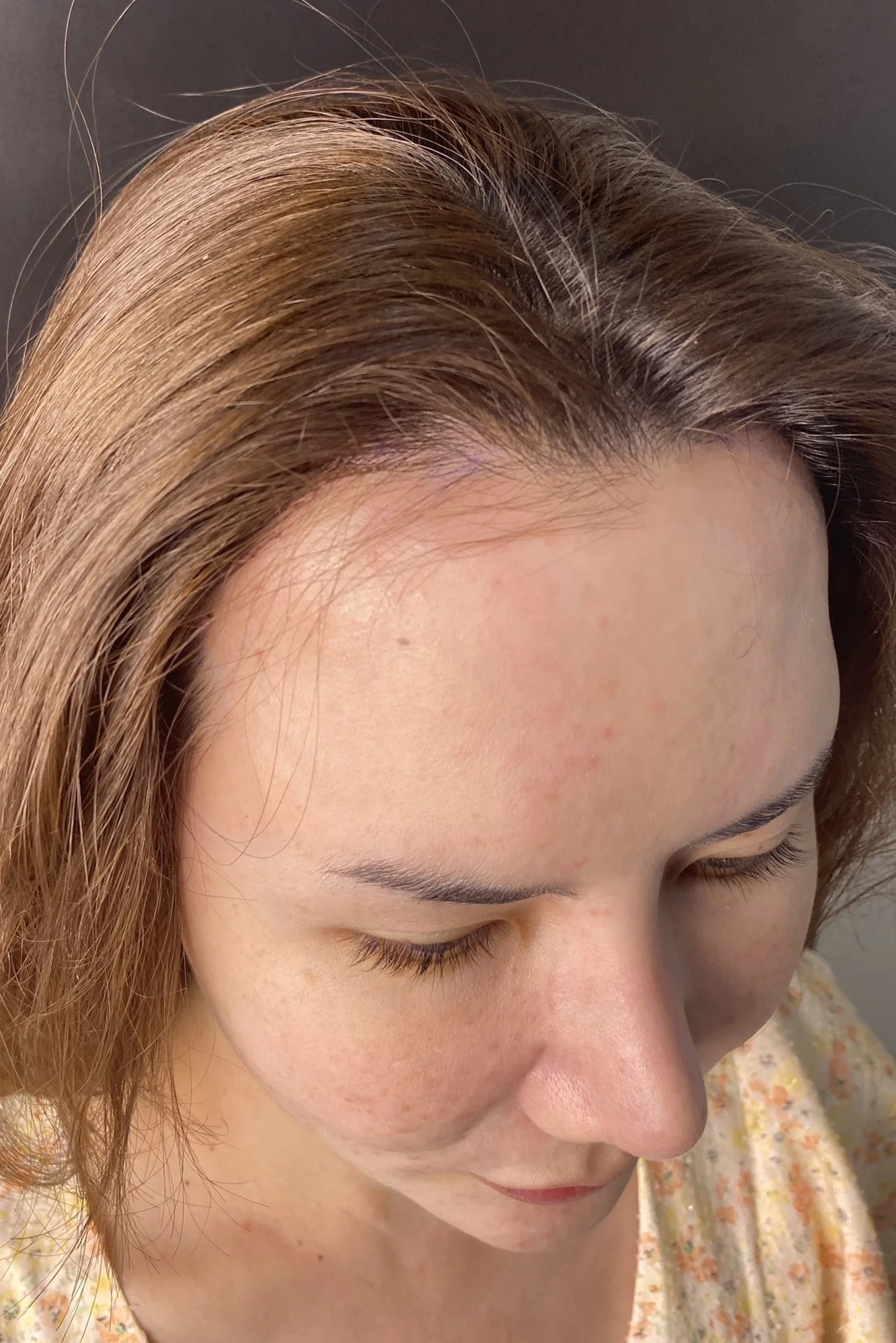 Mr. T, a 36-year-old client from Thailand