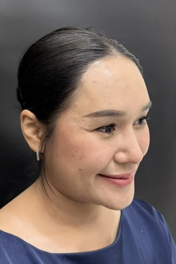 Mr. N, a 37-year-old client from Thailand