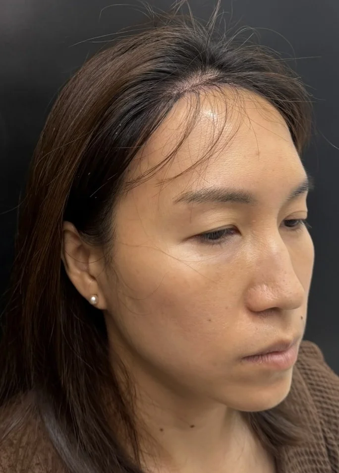 Mr. R, a 37-year-old client from Thailand