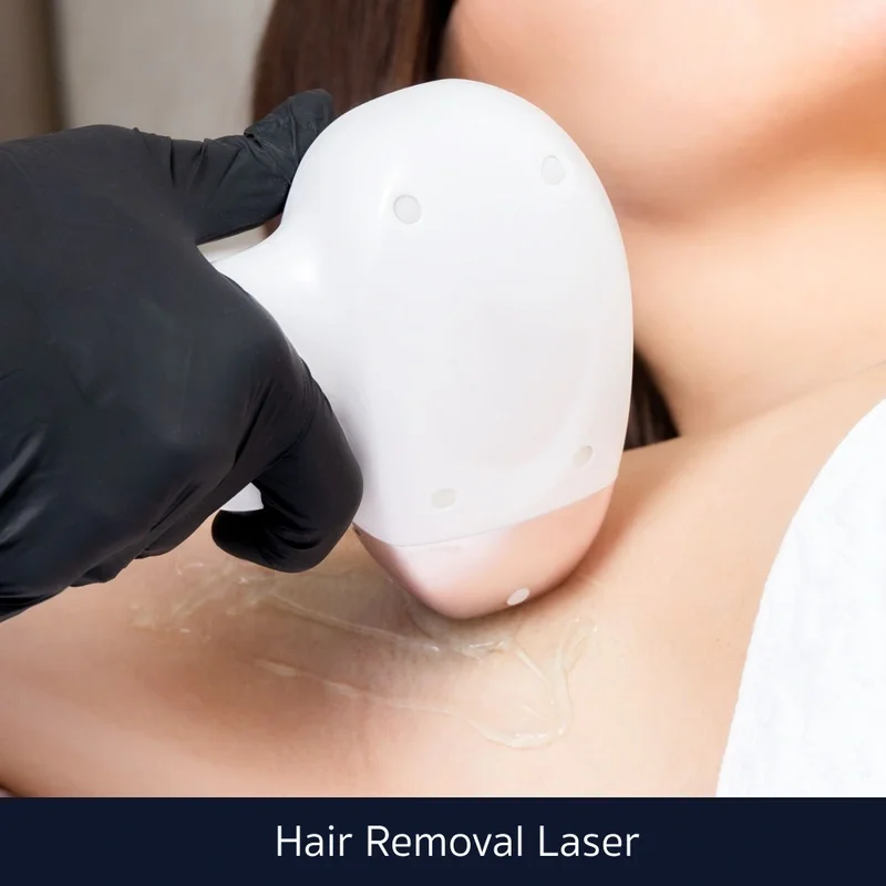 Hair Removal Laser