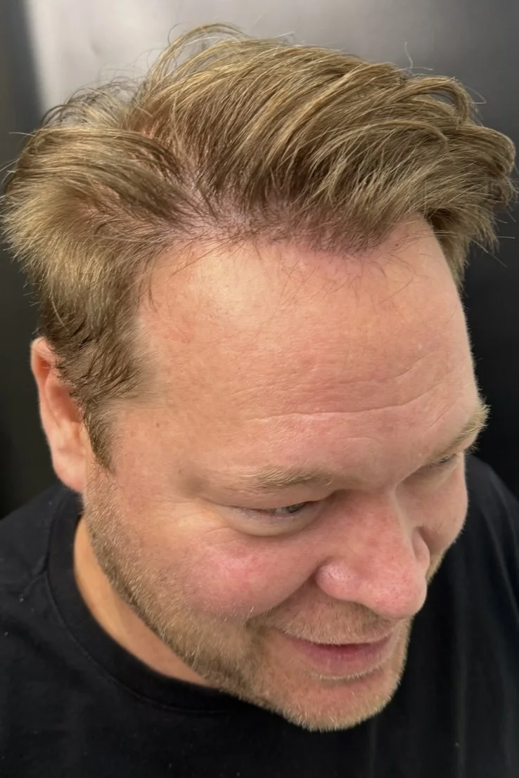 Mr. O, a 48-year-old client from the USA